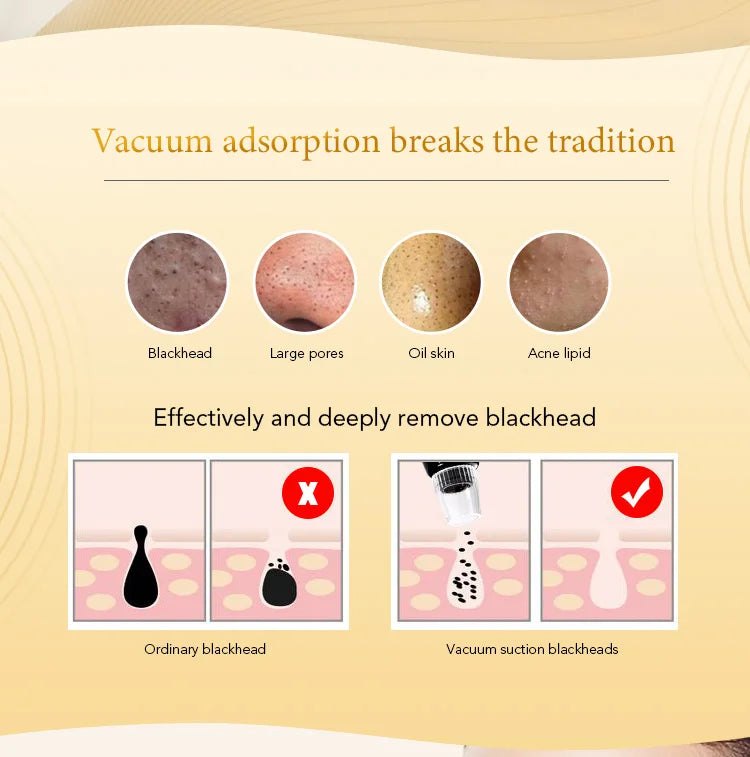 Electric Hot Blackhead and Pimple Removal Vacuum Suction Heated Blackhead Remover Face Deep Cleaner